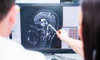 Forskere ser på hjernen